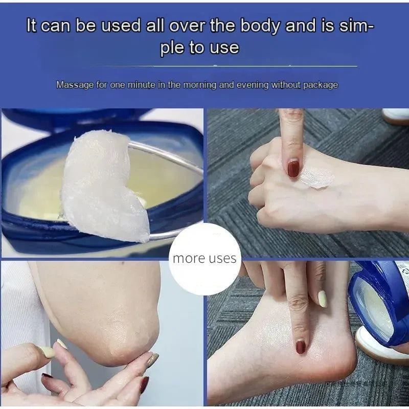 7/50/100g Vaseline Lip Balm Deep Hydrating Long Lasting Moisturizing Anti-cracking Cream For Hand Foot Heel Anti Dry Lip Mask