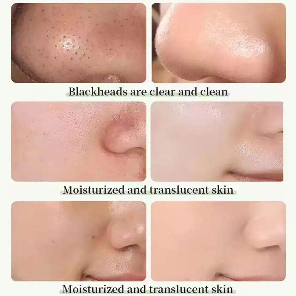 Eggplant Solid Green Tea Mask 1/5pc Deep Cleansing Shrink Pores Oil Control Cleanser  Tighten Skin Brightening Mud Skincare Mask