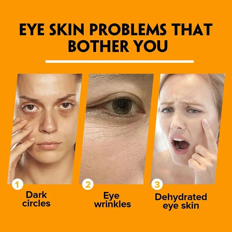 Fat Granules Removal Eye Cream Stick Anti Puffiness Firming Cream Antiaging Fade Fine Line Inflammatory Repair Barrier Skin Care
