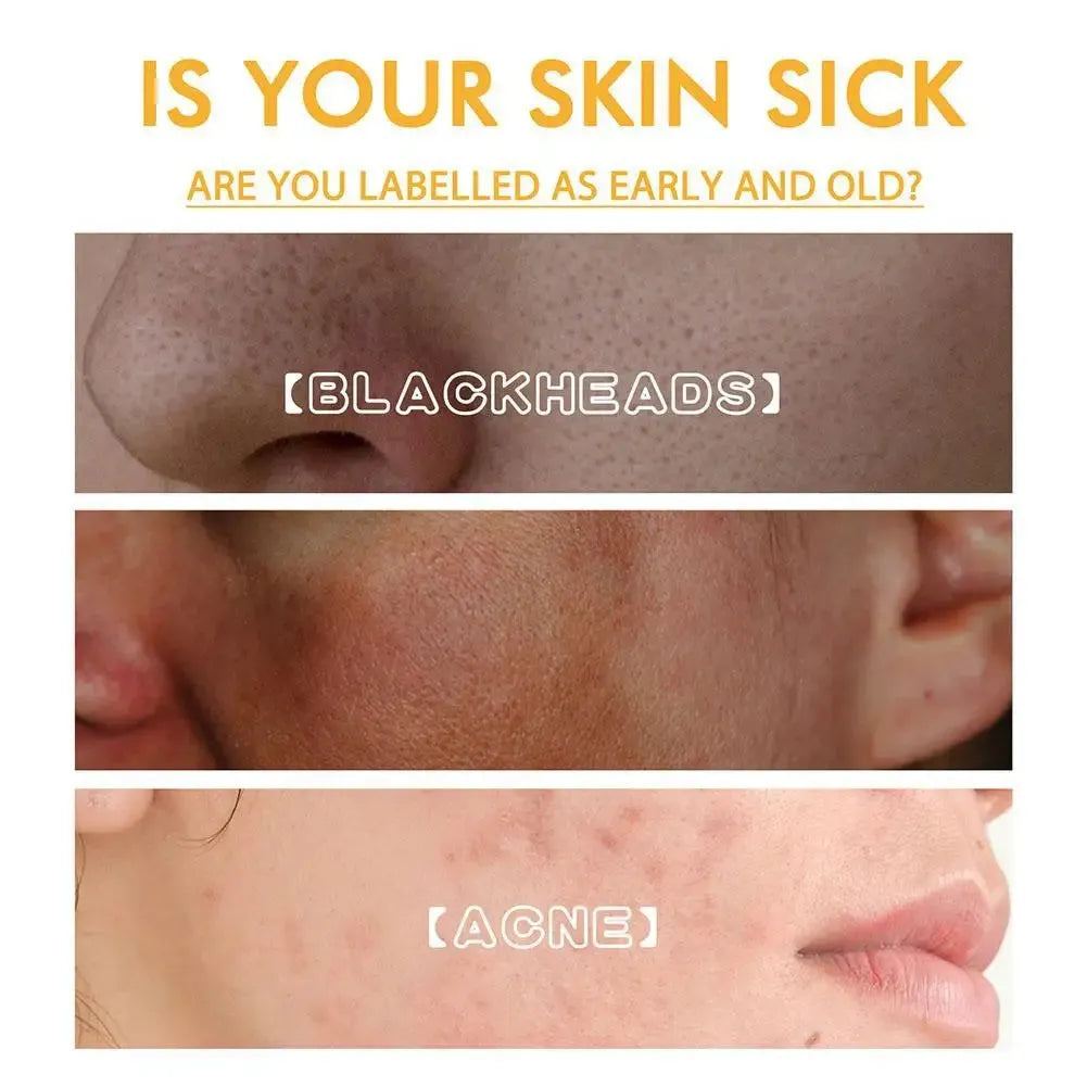 Honey Brighten tear-off mask skin whitening fade spots Firming pores white facial care bright moisturizing clean Beauty T1R7