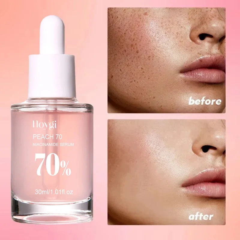 Peach 70% Niacinamide Serum Moisturizing Prevent Dryness Facial Essential Oil Increasing Elasticity Smooth Soften Skin Care 30ml