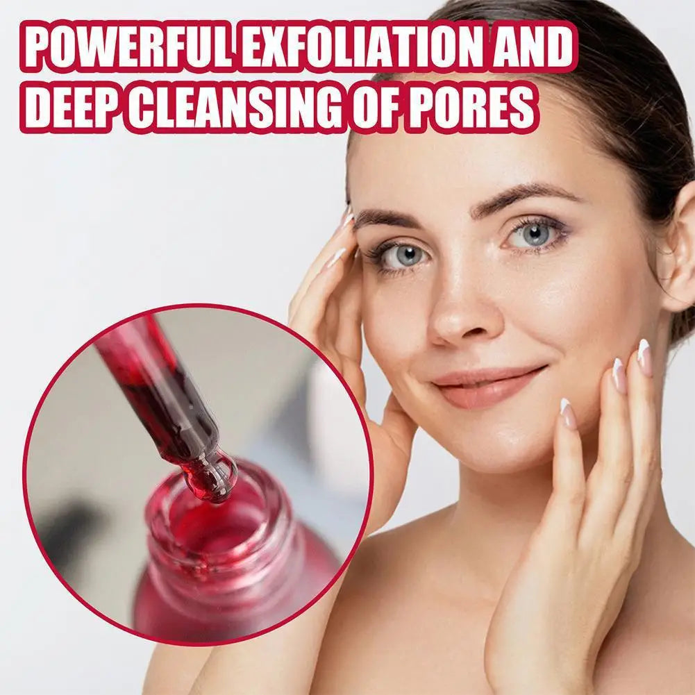 Salicylic Acid Serum Pores Shrinking Essence 30%AHA Product Treatment Moisturizing,exfoliate,Whitening,2%BHA Acne Face Care E6X6