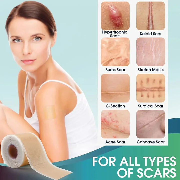 1Roll Silicone Scars Sheets Keloid Bump Removal Strips,Scars Reducing Treatments Surgical Scars, Burn,Tummy Tucks, C-Section