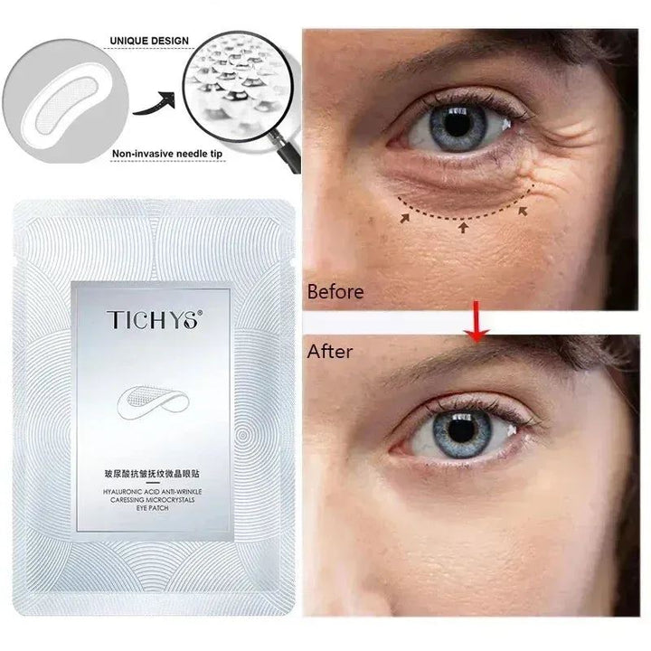 Micro-needle Eye Patch Hyaluronic Acid Anti-wrinkle Eye Mask Fine Lines Remove Moisturizing Eye Mask