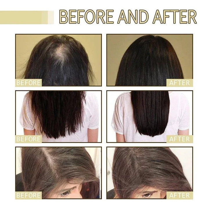 EELHOE Dense Hair Essential Oil Softens Nourishes Hair Repairs Hair Damage Prevents Hair Loss And Nourishes Hair Essence Oil New