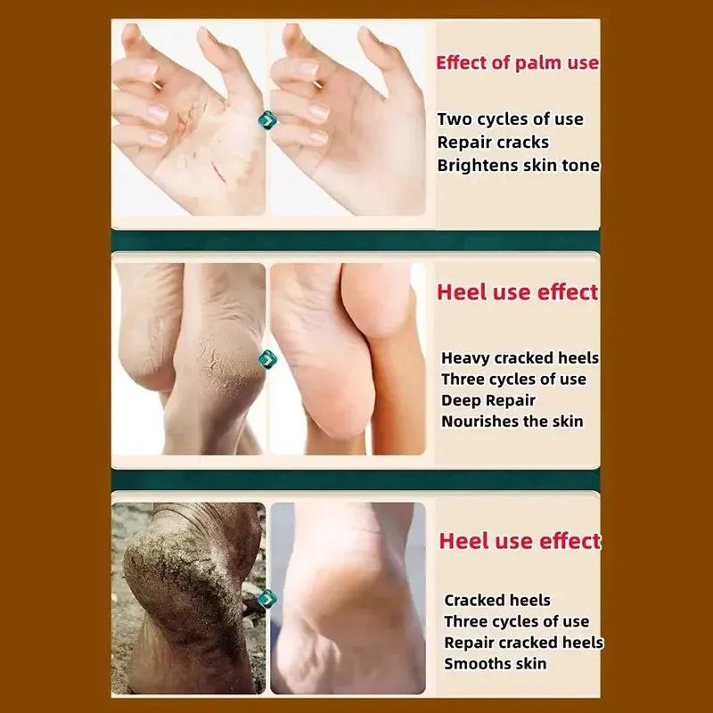 2024 Clam Oil Cracked Repair Cream Anti-Drying Removal Dead Skin Hand Feet Foot Moisturize Care Oil Care Ointment