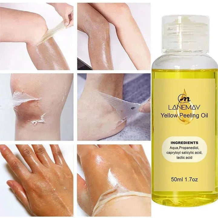 Body Care Exfoliating Yellow Peeling Oil 100% Organic Bleaching Dark Skin Serum Dark Kniten Exfoliating Dead Skin Care Serum New