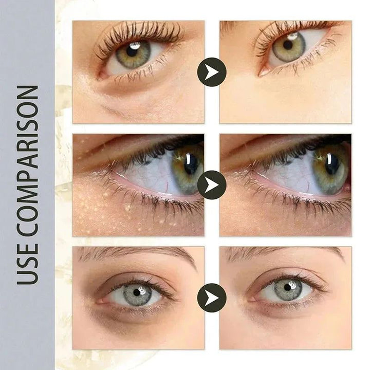 Fat Granules Removal Eye Cream Stick Anti Puffiness Firming Cream Antiaging Fade Fine Line Inflammatory Repair Barrier Skin Care