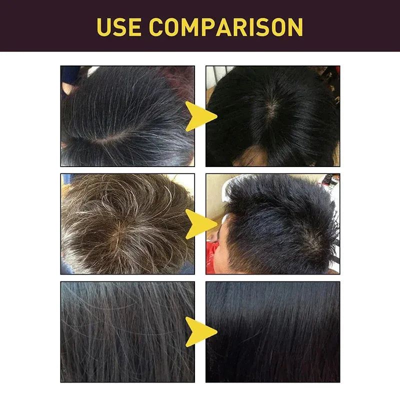3 In 1 Dye Shampoo For Hair For Women Men Grey Coverage For Gary Dark Brown Black Hair Health Natural Herbal Hair Dye Shampoo