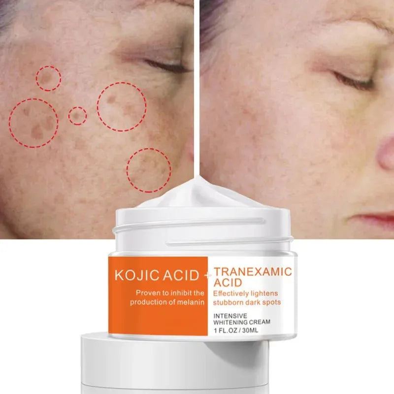 30ml Intensive Whitening Day Creams Moisturizers Acid Tranexamic Acid Inhibit Melanin Lightens Stubborn Dark Spots