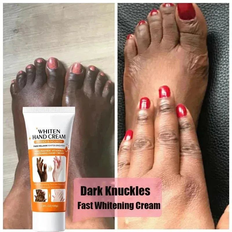 2024 Dark Knuckles Fast Whitening Serum Anti Cracking Cream Pigmentation Correctors For Black Skin Fast Stains Remover Products