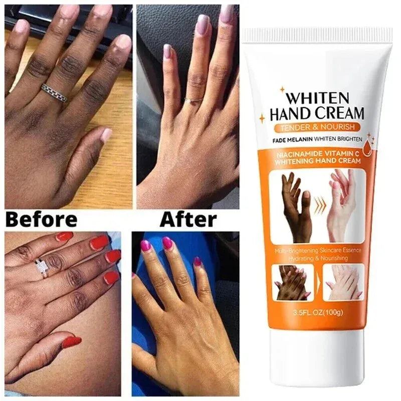2024 Dark Knuckles Fast Whitening Serum Anti Cracking Cream Pigmentation Correctors For Black Skin Fast Stains Remover Products