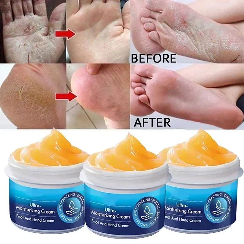 30g Anti Crack Foot Hand Cream Anti-Drying Heel Cracked Repair Hand Feet Mask Moisturizing Whitening Remover Dead Skin Feet Care