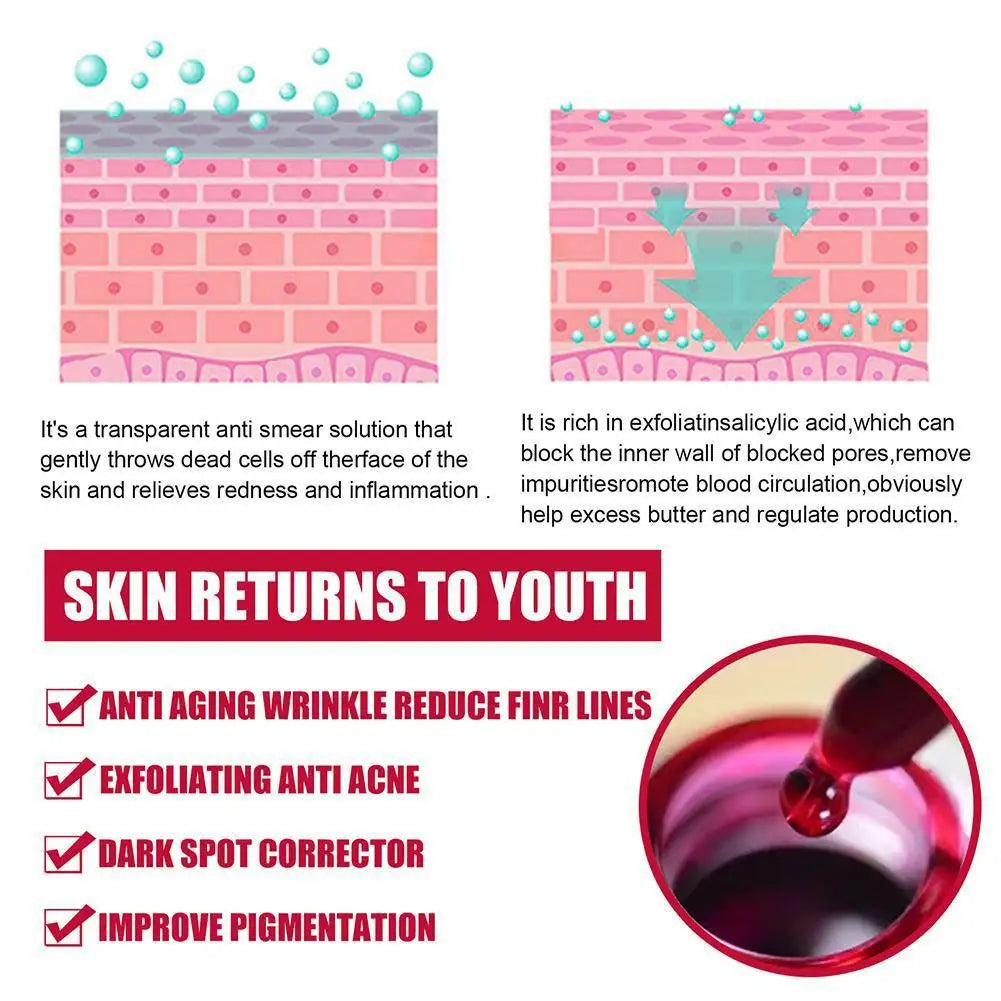 Salicylic Acid Serum Pores Shrinking Essence 30%AHA Product Treatment Moisturizing,exfoliate,Whitening,2%BHA Acne Face Care E6X6