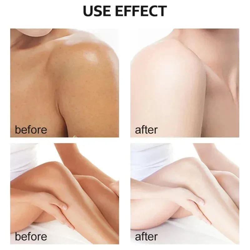 Body Care Exfoliating Yellow Peeling Oil 100% Organic Bleaching Dark Skin Serum Dark Kniten Exfoliating Dead Skin Care Serum New