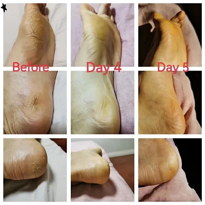 2024 Clam Oil Cracked Repair Cream Anti-Drying Removal Dead Skin Hand Feet Foot Moisturize Care Oil Care Ointment