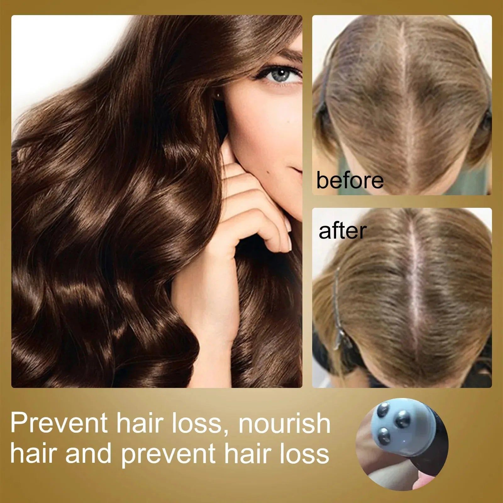 Hair Growth Essence Oil Roll-on Massage The Scalp To Accelerate Absorption Scalp Irritation Nourish Hair Roots Prevent Hair Loss